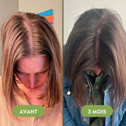 Haar-Wiederherstellungs-Set