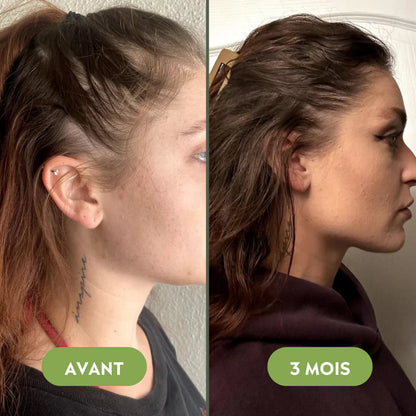 Haar-Wiederherstellungs-Set