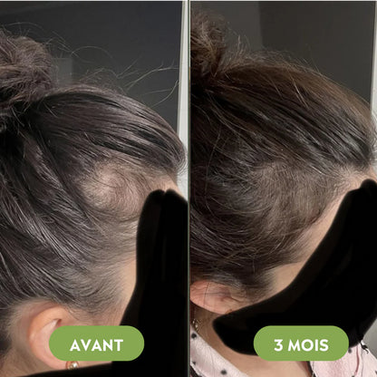 Haar-Wiederherstellungs-Set