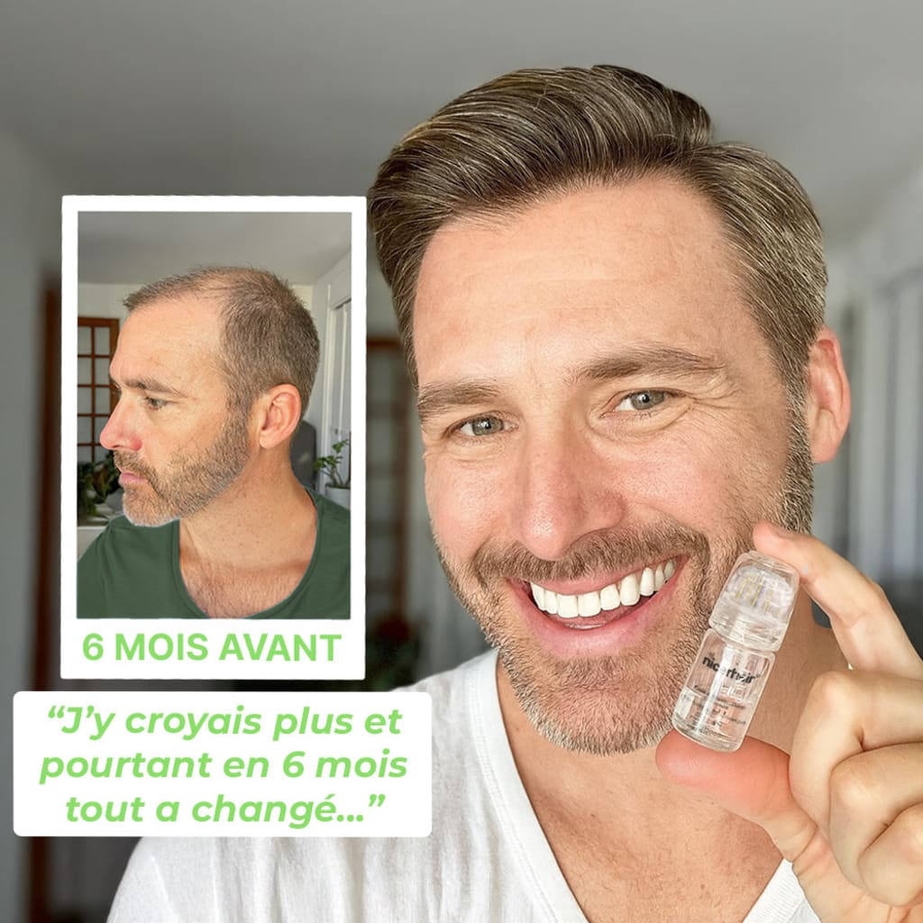 Kit Renouvellement Capillaire